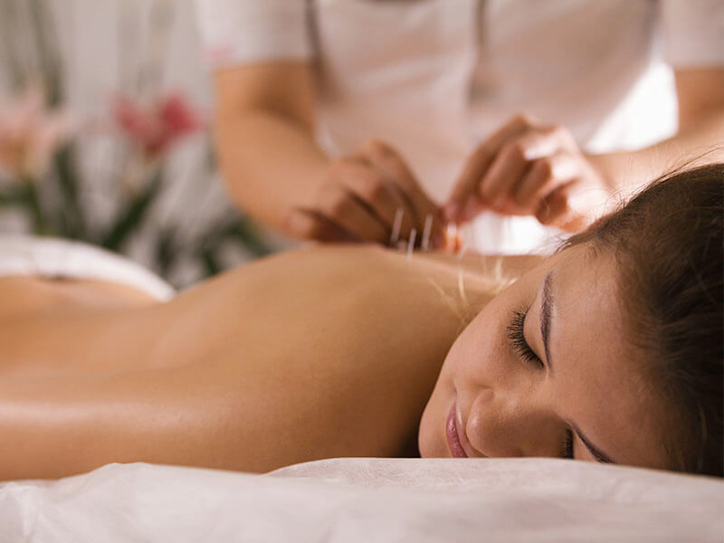 acupuncture southbank